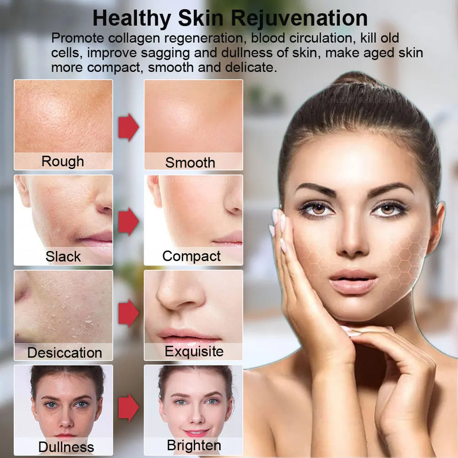 High Frequency Skin Rejuvenation Machine