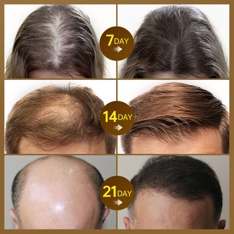 Hair Growth Products  for Men Women Beauty Health Care