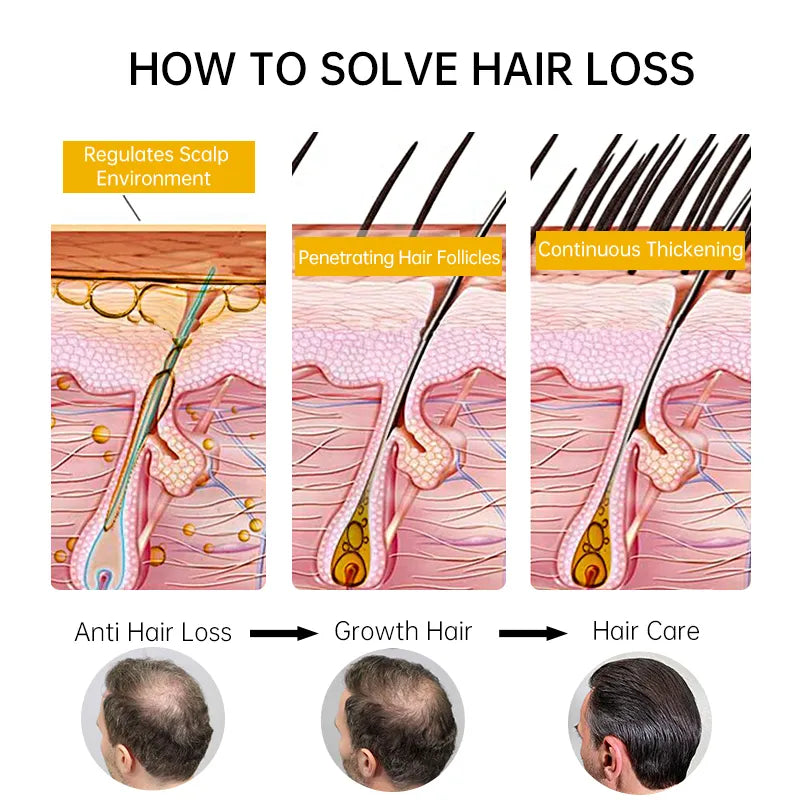 Fast Hair Growth  Care for Men Women