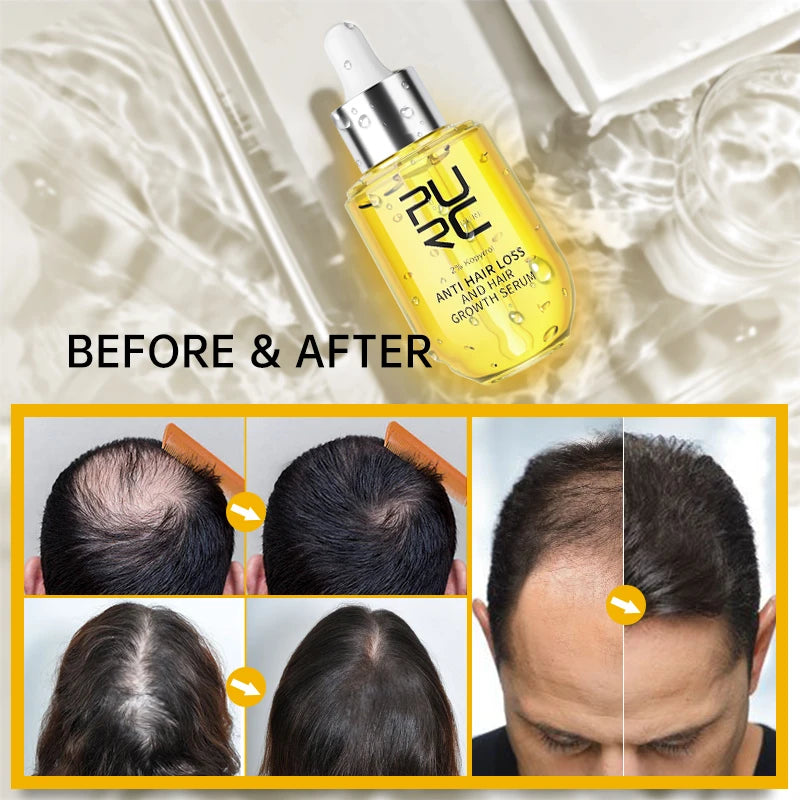 Fast Hair Growth  Care for Men Women