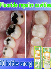 Scientific fluoride repairs cavities, removes cavities, cleans plaque, whitens teeth, and freshens breath